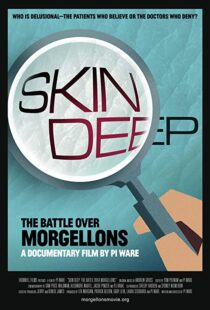 دانلود مستند Skin Deep: The Battle Over Morgellons 2019104233-859452342
